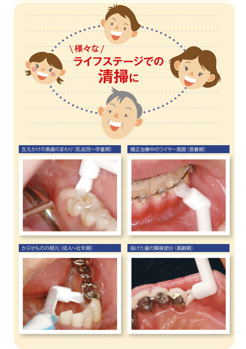 矯正治療中周囲 思春期