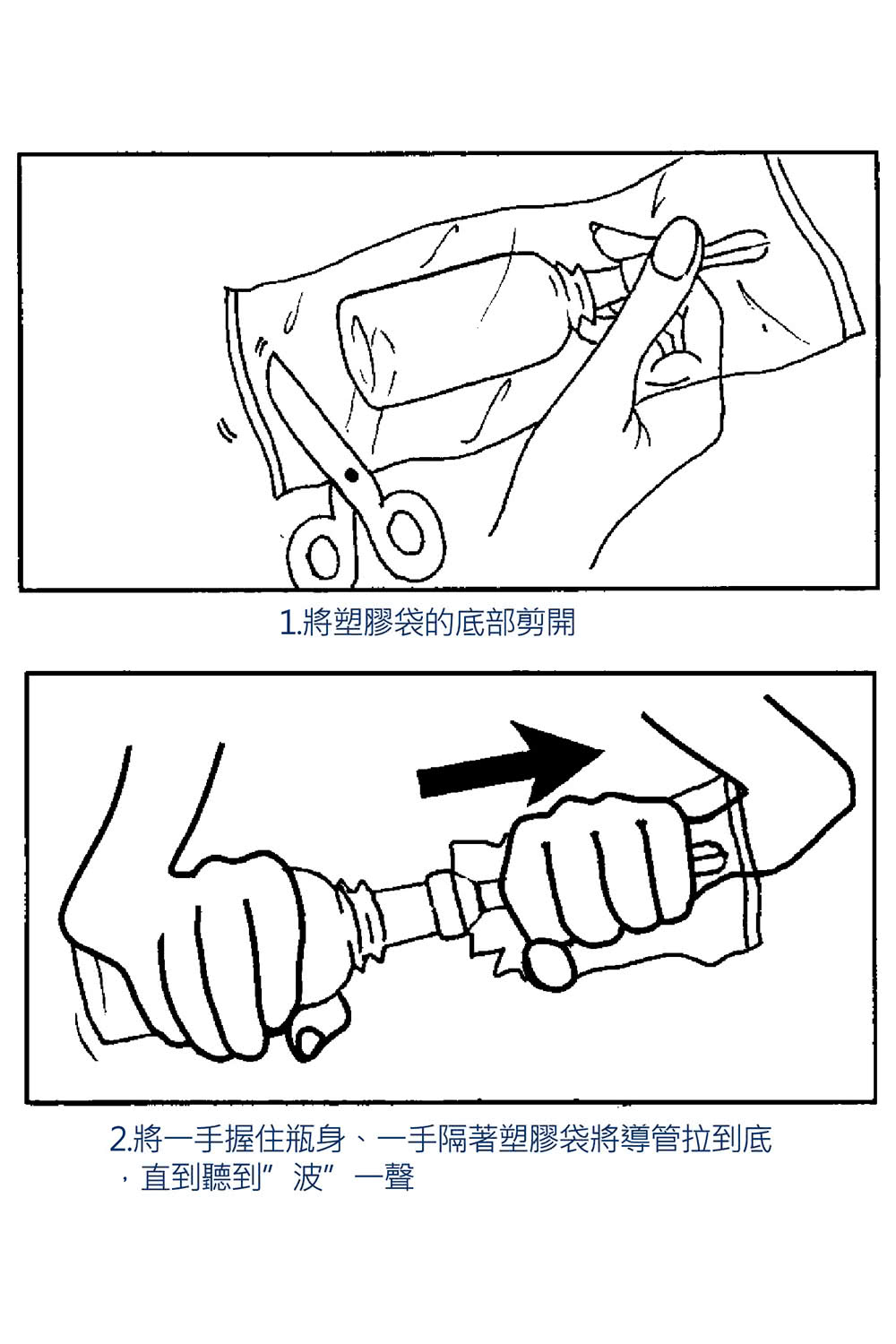 1.將塑膠袋的底部剪開 2.將一手握住瓶身、一手隔著塑膠袋將導管拉到底 直到聽到波一聲 