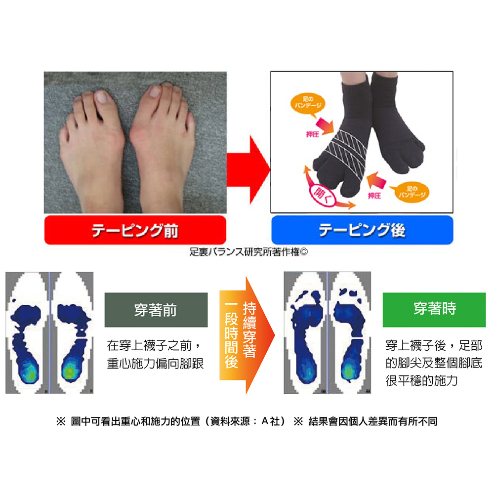 日本整骨研發姆趾足弓校正襪2 1超值組 Momo購物網
