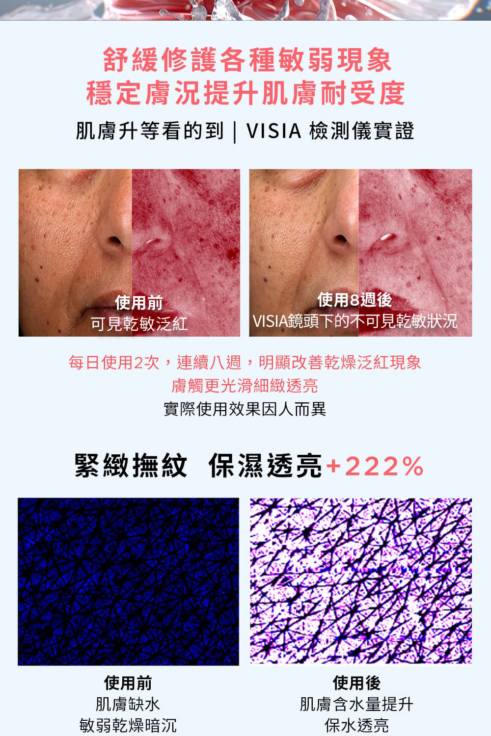 æ¯æ¥ä½¿ç¨2æ¬¡,é£çºå«é±,æé¡¯æ¹åä¹¾ç¥æ³ç´ç¾è±¡