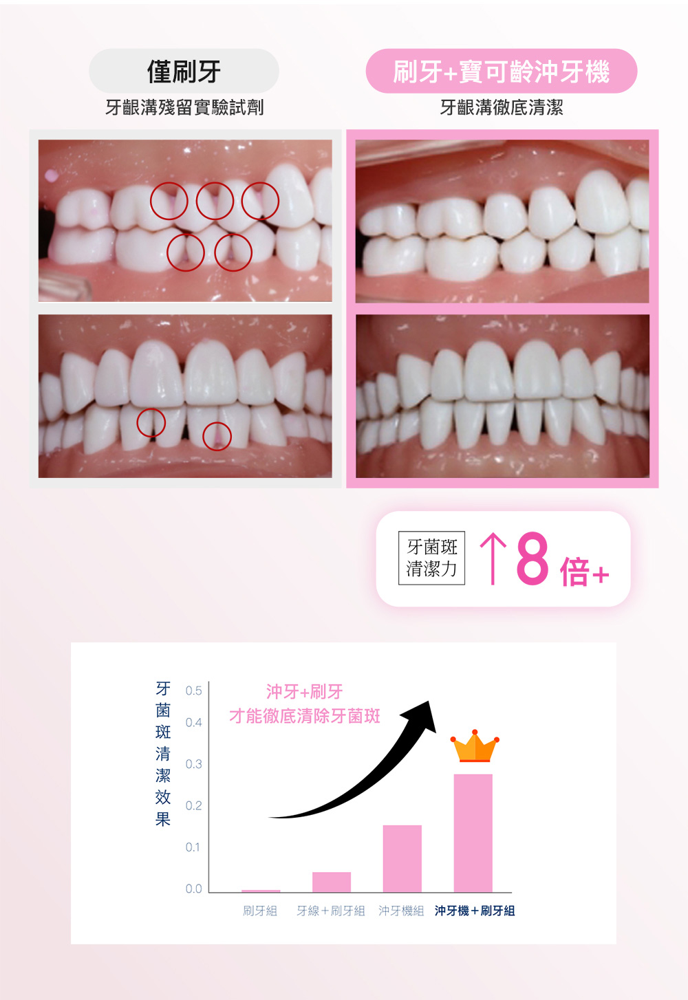 刷牙組 牙線刷牙組 沖牙機組 沖牙機刷牙組