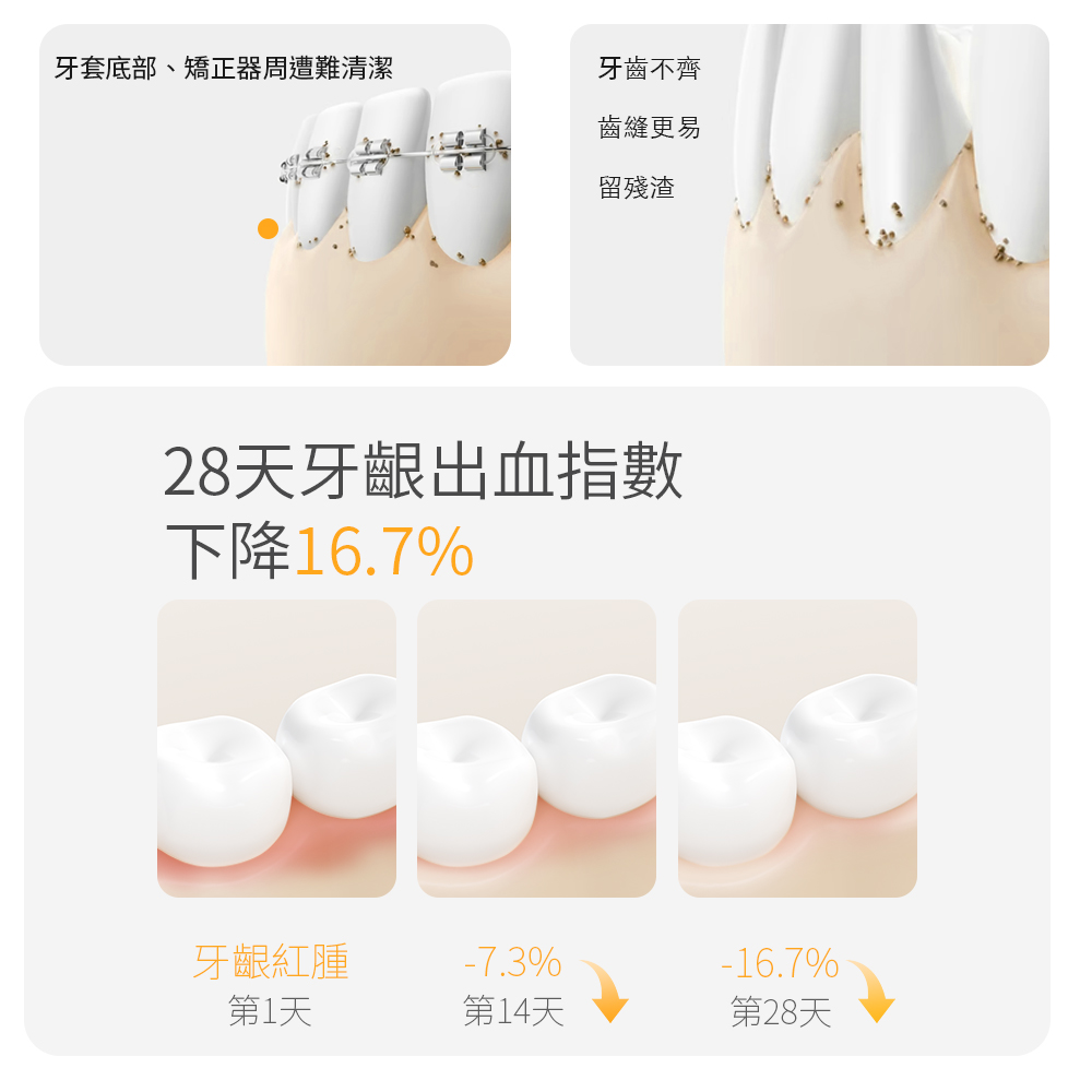 牙套底部、矯正器周遭難清潔