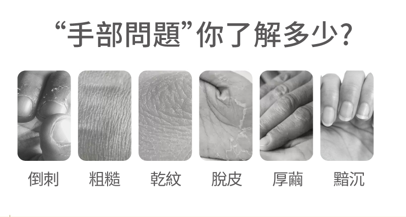手部問題你了解多少 倒刺 粗糙 乾紋 脫皮 厚繭 黯沉 
