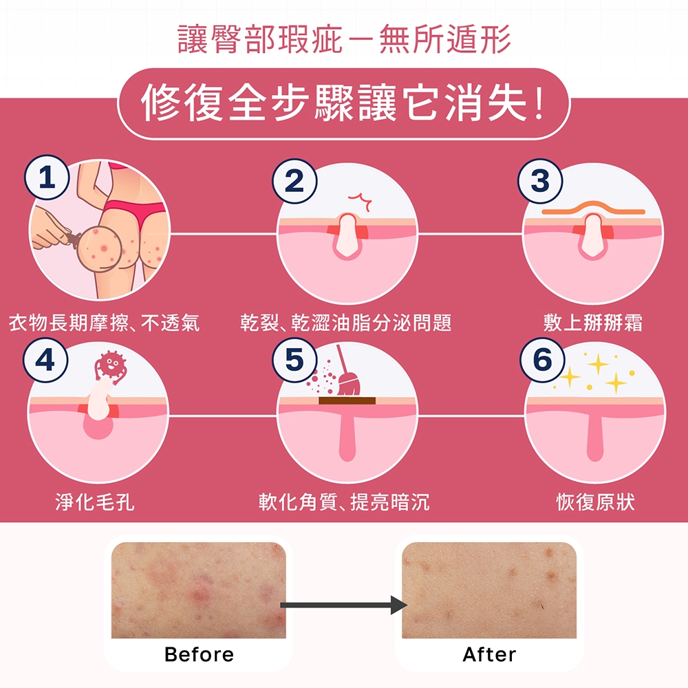 乾裂、乾澀油脂分泌問題