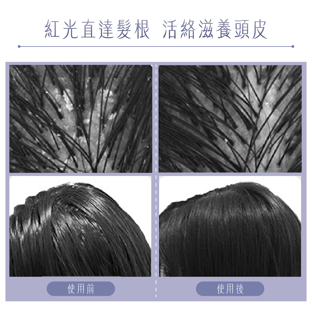 紅光直達髮根 活絡滋養頭皮使用前使用後